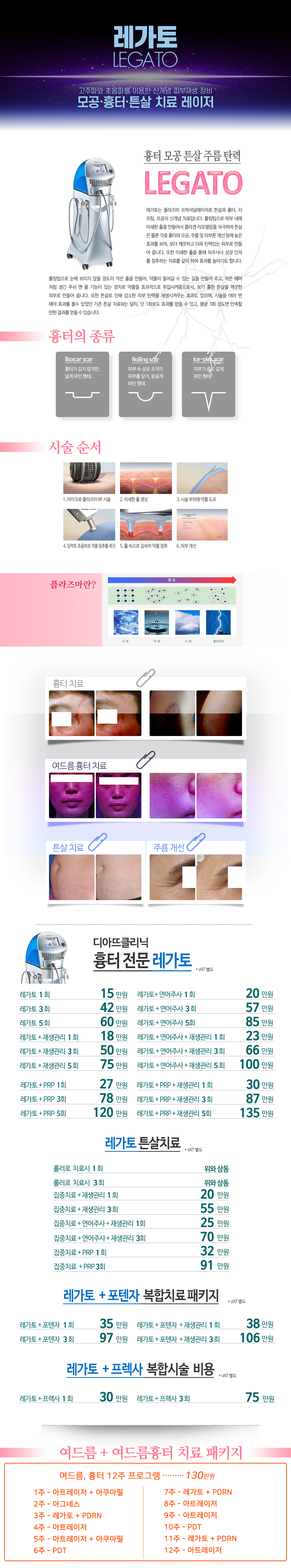 레가토 상세 안내 이미지 1